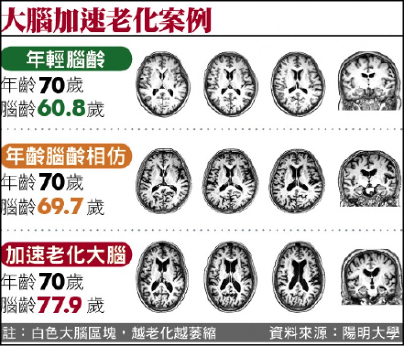大腦超齡一歲死亡風險增6 臺灣醫療知識社群